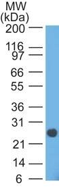 Western Blot analysis of human intestinal lysate using Lambda Light Chain Antibody (HP6054) - IHC-Prediluted.