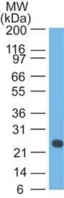 Western Blot: Lambda Light Chain Antibody (LcN-2 + ICO-106) - IHC-Prediluted [NBP2-45077] - Western blot analysis of Lambda Light Chain in human intestine using Lambda Light Chain Ab (LcN-2+ICO-106).