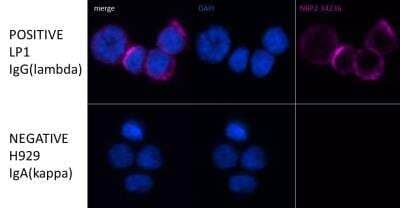 Immunocytochemistry/ Immunofluorescence: Lambda Light Chain Antibody (LcN-2 + ICO-106) - IHC-Prediluted [NBP2-45077] - Staining of human LP-1 and H929 multiple myeloma cells. 1. Cells immersion-fixed in 2% PFA 10 minutes, wash PBS X 32. Permeabilized 0.5% Triton X-100 5 minutes; wash PBS X 33. Block 10% donkey serum 1 hour4. 1/200 NBP2-34236 O/N at 4C; wash PBS X 35. 1/1000 donkey F(ab')2  Alexa Fluor 647 anti-mouse IgG (H+L) 1 hour at room temperature and wash with PBS X 3.6. Olympus/BIOVIEW Cy5 filter 600ms exposure.  Image from a verified customer review.