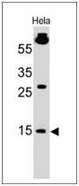 Western Blot of HeLa cell lysate using SUMO1 Antibody (SM1/495) - IHC-Prediluted