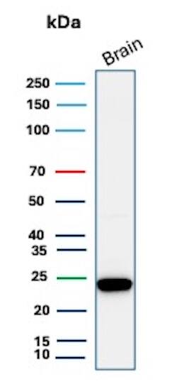Western Blot Analysis of human brain tissue lysate using UCH-L1/PGP9.5 Antibody (31A3) - IHC-Prediluted. 