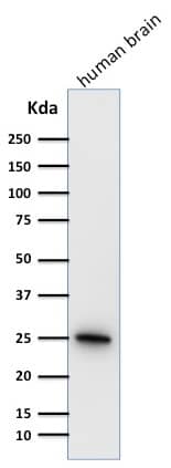 Western Blot Analysis of human brain tissue lysate using UCH-L1/PGP9.5 Antibody (31A3) - IHC-Prediluted.