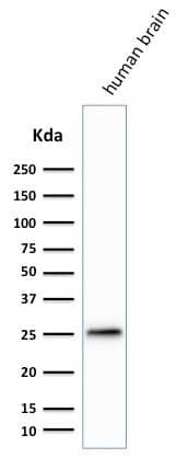 Western Blot Analysis of human Brain lysate using UCH-L1/PGP9.5 Antibody (SPM574) - IHC-Prediluted.