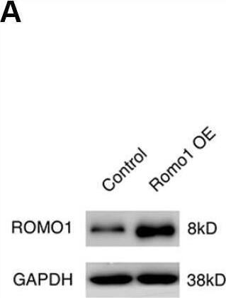 The overexpression of Romo1 in bone marrow cells dampened the immune response in glioblastoma. (A) The overexpression of Romo1 in the bone marrow cells transfected with Romo1-lentivirus (the right lane) was validated by western blotting. The protein sample of the bone marrow cells transfected with control lentivirus (the left lane) was used as control. (B, C) The tumor growth curve (B) and the survival curve (C) of the mice receiving the control bone marrow allografts alone (n=6) or in combination of clodronate liposomes (200ul of each mouse every 3 days, n=6),, and the mice receiving the Romo1-overexpressed bone marrow allografts alone (n=6) in combination of in combination of clodronate liposomes (200ul of each mouse every 3 days, n=6) after orthotopic injection of GL261 cells. (D) The tumor sections were analyzed by immunohistochemistry with CD3 antibody, and the infiltrating CD3+ T cells around tumors were quantified and statistically analyzed. Arrows indicate CD3+ T cells. (E) The frequencies of IFN-gamma -producing CD4+ or CD8+ T cells in tumors of both groups were determined by flow cytometry and statistically analyzed. (F) The frequencies of GzmB-producing CD4+ or CD8+ T cells in tumors of both groups were determined by flow cytometry and statistically analyzed. (G) The tumor sections from both groups were analyzed by immunohistochemistry with Ki-67 antibody and statistically analyzed from three independent experiments. Arrows indicate the Ki-67+ cells. *, P < 0.05; **, P < 0.01. Image collected and cropped by CiteAb from the following open publication (//pubmed.ncbi.nlm.nih.gov/31945745), licensed under a CC-BY license. Not internally tested by Novus Biologicals.