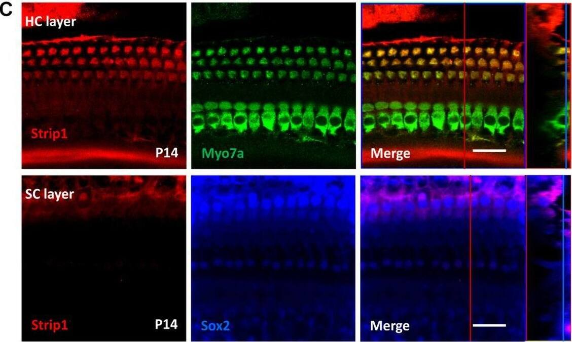 Immunofluorescent staining of Strip1 in the mouse cochlea at different ages. (A–F) The Strip1 antibody was used to stain Strip1 in mouse cochleae at P3 (A), P7 (B), P14 (C), P21 (D), P30 (E), and P60 (F). Because nucleus of SCs staining by Sox2 antibody are not always in the same layer, Z projection was performed with the ImageJ software in order to capture all the SCs in the images. (G) The immunofluorescent staining of P30 cochlear cryosections also showed the same expression pattern of Strip1. Myo7a and Sox2 were used as HC and SC markers, respectively. Scale bar, 20 μm. Image collected and cropped by CiteAb from the following open publication (//pubmed.ncbi.nlm.nih.gov/33889175), licensed under a CC-BY license. Not internally tested by Novus Biologicals.