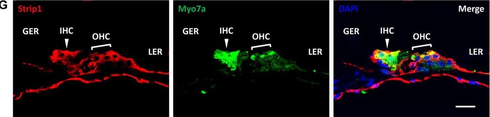 Immunofluorescent staining of Strip1 in the mouse cochlea at different ages. (A–F) The Strip1 antibody was used to stain Strip1 in mouse cochleae at P3 (A), P7 (B), P14 (C), P21 (D), P30 (E), and P60 (F). Because nucleus of SCs staining by Sox2 antibody are not always in the same layer, Z projection was performed with the ImageJ software in order to capture all the SCs in the images. (G) The immunofluorescent staining of P30 cochlear cryosections also showed the same expression pattern of Strip1. Myo7a and Sox2 were used as HC and SC markers, respectively. Scale bar, 20 μm. Image collected and cropped by CiteAb from the following open publication (//pubmed.ncbi.nlm.nih.gov/33889175), licensed under a CC-BY license. Not internally tested by Novus Biologicals.