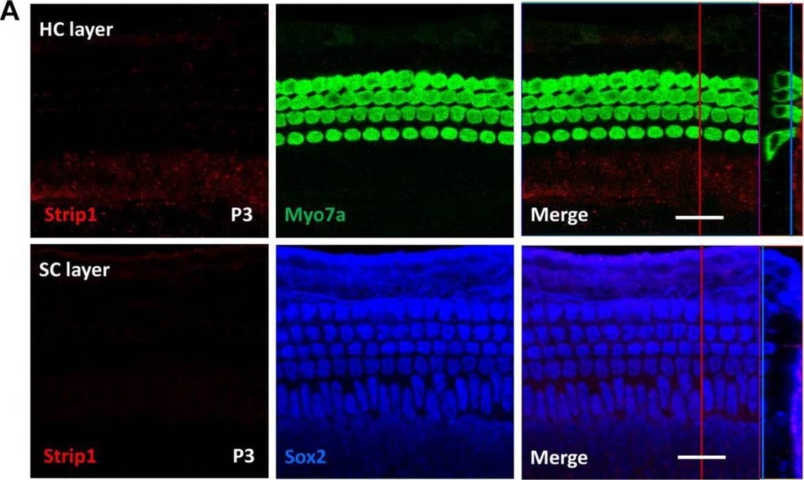 Immunofluorescent staining of Strip1 in the mouse cochlea at different ages. (A–F) The Strip1 antibody was used to stain Strip1 in mouse cochleae at P3 (A), P7 (B), P14 (C), P21 (D), P30 (E), and P60 (F). Because nucleus of SCs staining by Sox2 antibody are not always in the same layer, Z projection was performed with the ImageJ software in order to capture all the SCs in the images. (G) The immunofluorescent staining of P30 cochlear cryosections also showed the same expression pattern of Strip1. Myo7a and Sox2 were used as HC and SC markers, respectively. Scale bar, 20 μm. Image collected and cropped by CiteAb from the following open publication (//pubmed.ncbi.nlm.nih.gov/33889175), licensed under a CC-BY license. Not internally tested by Novus Biologicals.