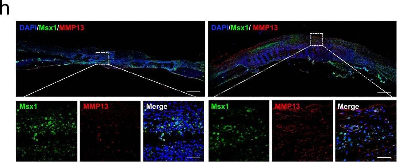 Immunocytochemistry/ Immunofluorescence MMP-13 Antibody (OTI2D8)