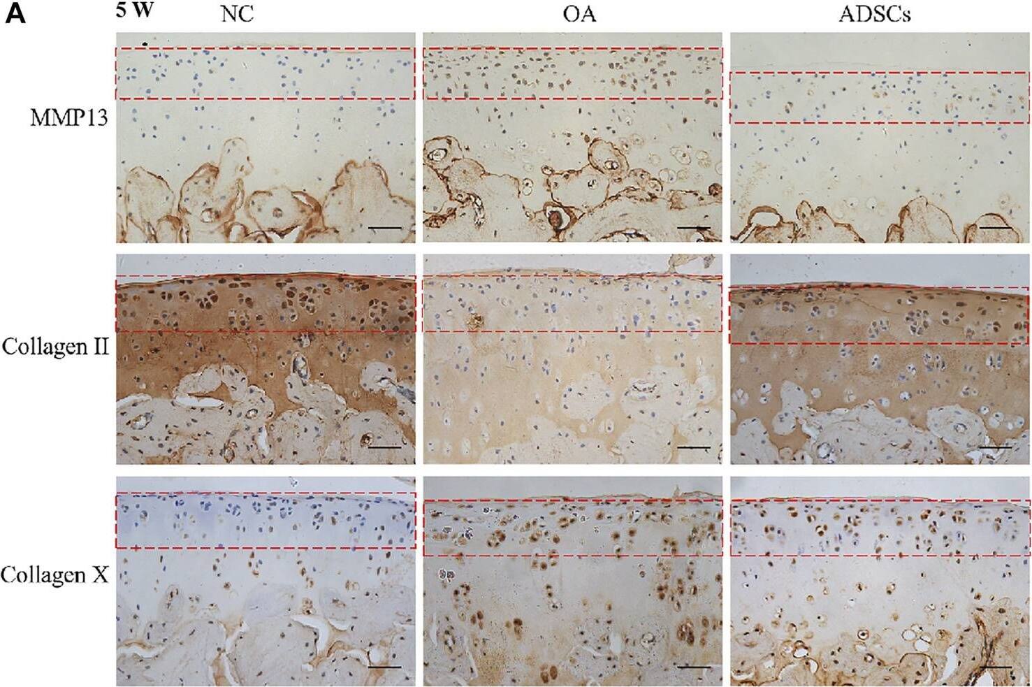 Immunohistochemistry MMP-13 Antibody (OTI2D8)