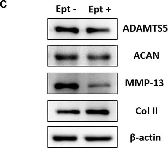 Western Blot MMP-13 Antibody (OTI2D8)