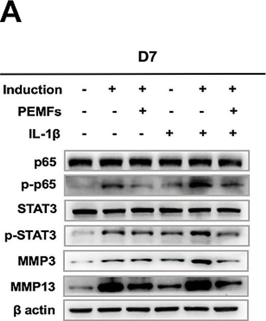 Western Blot MMP-13 Antibody (OTI2D8)