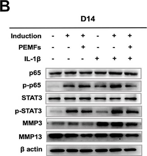 Western Blot MMP-13 Antibody (OTI2D8)
