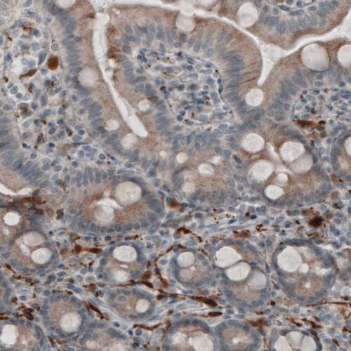 Staining of human duodenum shows staining in peripheral nerve fibers.