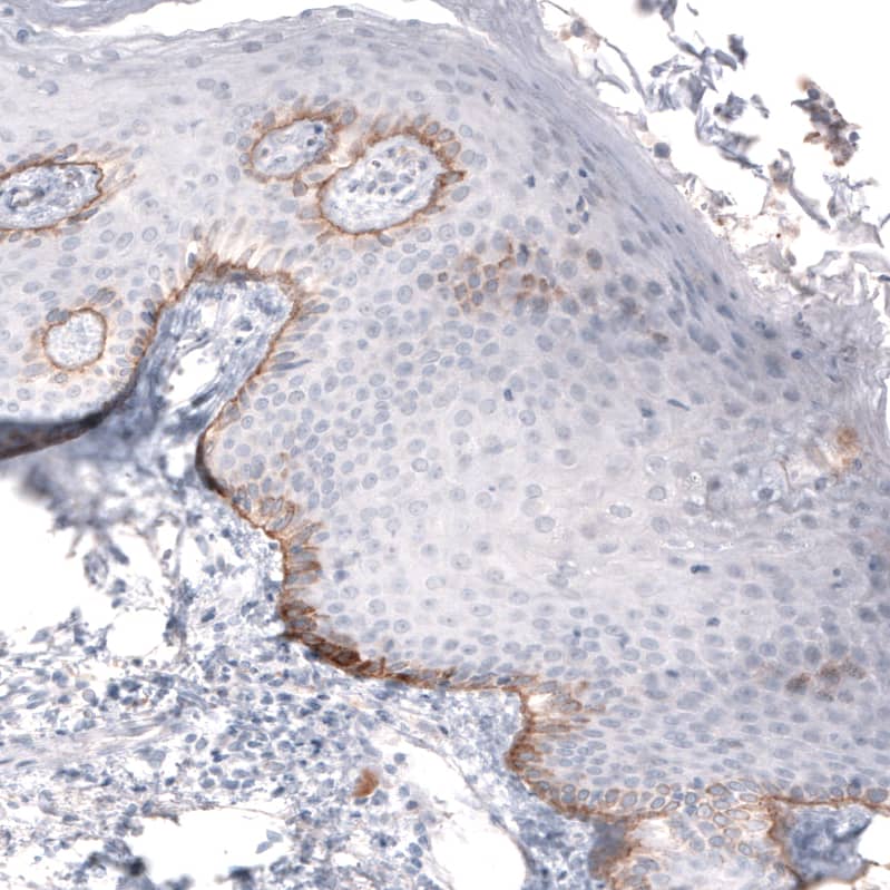 Immunohistochemistry-Paraffin Laminin beta 3 Antibody (CL3353) - BSA Free