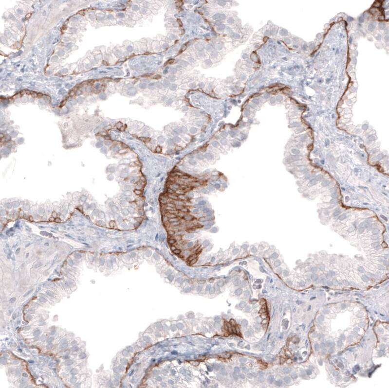 Staining of human prostate shows moderate to strong positivity in basement membrane of glandular cells.