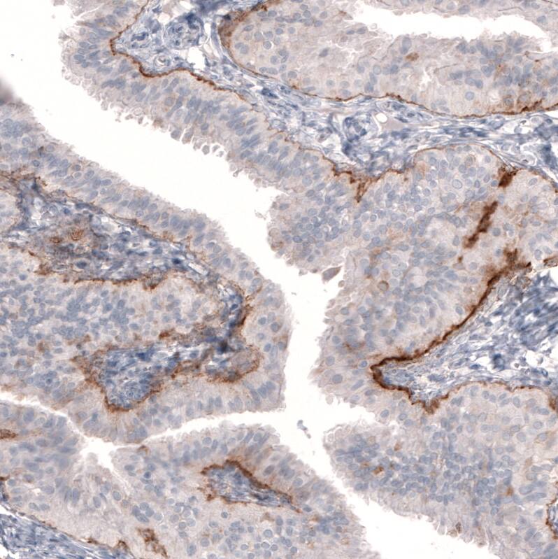 Staining of human fallopian tube shows moderate to strong positivity in basement membrane of glandular cells.