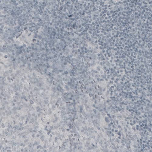 Staining of human tonsil shows absence of immunoreactivity (negative control).