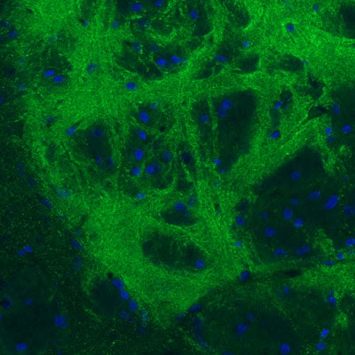 Staining of rat globus pallidus shows strong immunoreactivity in GABAergic neural fibers.