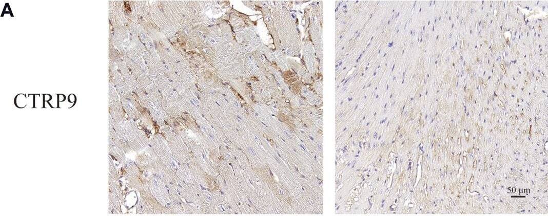 CTRP9 expression was diminished within the cardiac tissue of diabetic mice. (A) Illustrative immunohistochemistry images of CTRP9 in two groups. (B) Assessment of CTRP9 in two groups. (C) Illustrative Western blot of CTRP9 in animals. (D) Assessment of CTRP9 in two groups. (E) Illustrative Western blot of CTRP9 in cardiac fibroblasts. (F) Measurement of CTRP9 in two groups. Scale bar = 50 μm. The data are depicted as the mean +/- SEM (n = 5–6). *p < 0.05, ****p < 0.0001. Image collected and cropped by CiteAb from the following open publication (//www.frontiersin.org/articles/10.3389/fphar.2024.1407883/full), licensed under a CC-BY license. Not internally tested by Novus Biologicals.