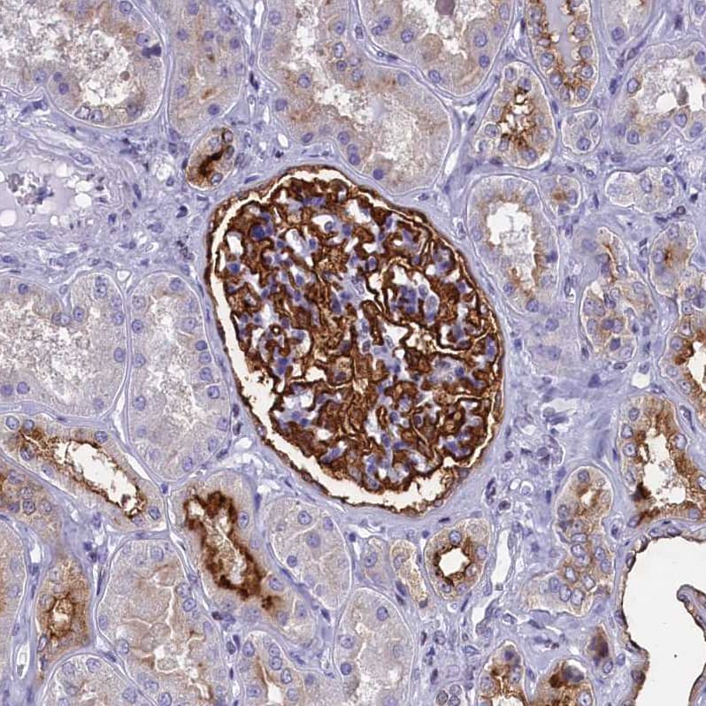 Immunohistochemistry-Paraffin SPIRE2 Antibody - BSA Free