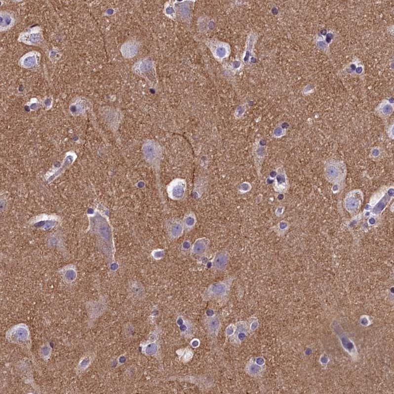 Staining of human cerebral cortex shows moderate  positivity in neuropil.