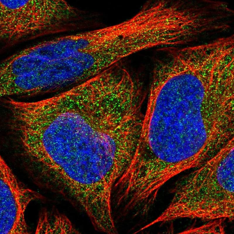 Staining of human cell line U-2 OS shows localization to cytosol.
