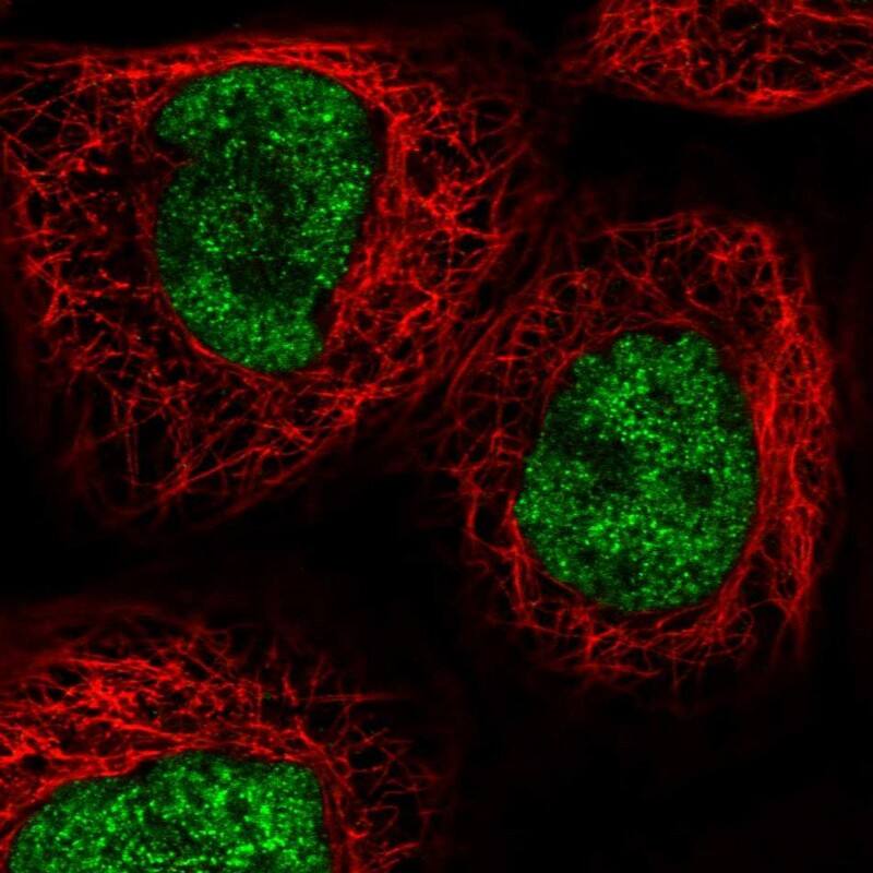 Staining of human cell line A-431 shows localization to nucleoplasm.