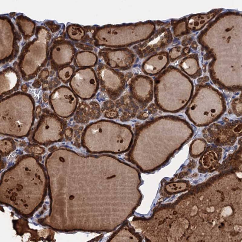 Staining of human thyroid gland shows strong cytoplasmic positivity in glandular cells.