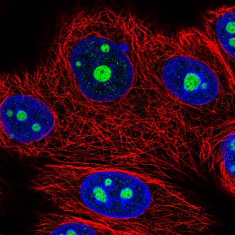 Immunocytochemistry/ Immunofluorescence NOM1 Antibody - BSA Free