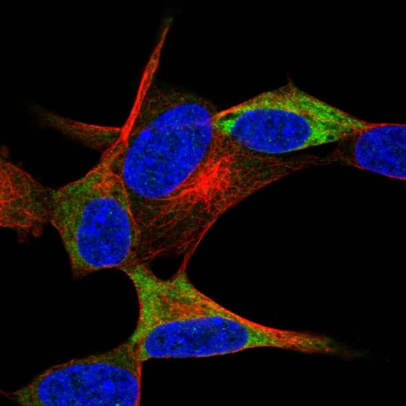 Staining of human cell line SH-SY5Y shows localization to cytosol.