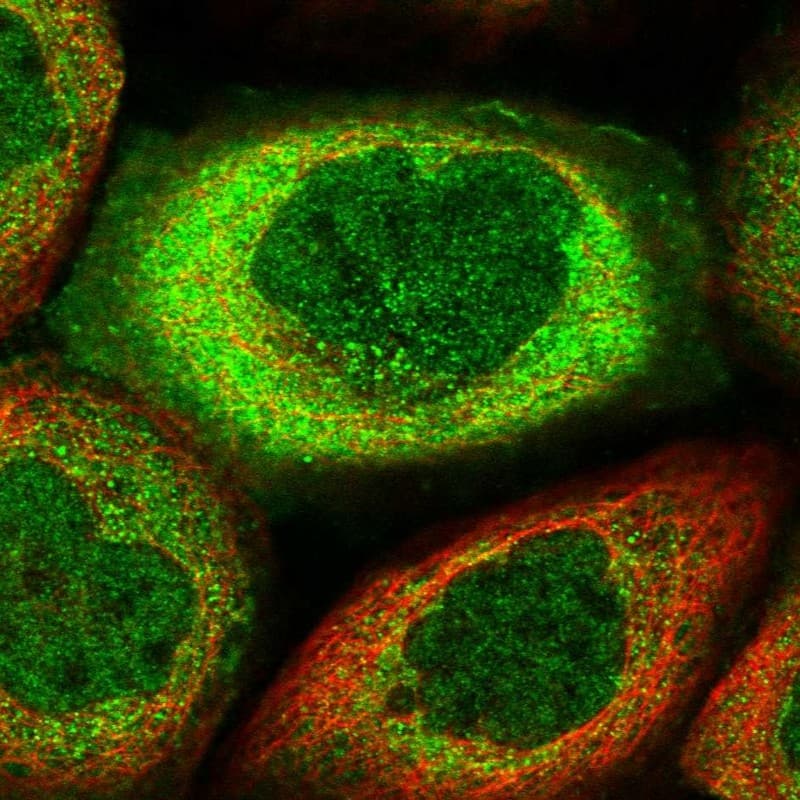 Staining of human cell line A-431 shows localization to nucleoplasm & cytosol.