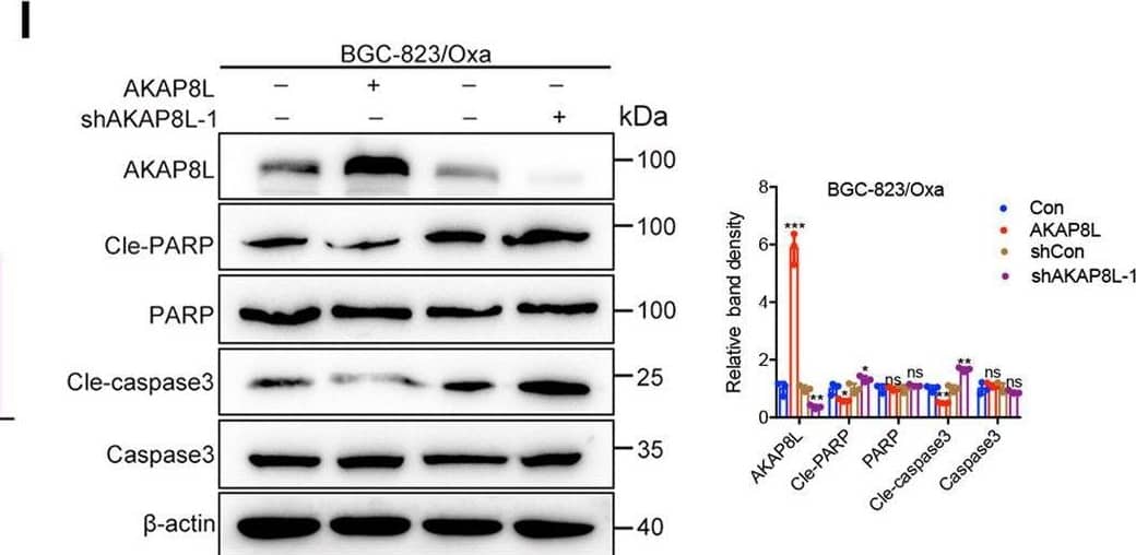 AKAP8L controls the chemoresistance in vivo.A 1 × 106 AKAP8L-overexpressing or AKAP8L-knockdown BGC-823/Oxa were implanted in nude mice (tumor development following treatment with Oxa once a week), tumors were dissected and representative images of the tumors are shown. B, C Tumor growth curves for orthotopic models. D Representative images of immunofluorescence staining of AKAP8L, Ki-67 and quantification analysis of AKAP8L, Ki-67 positive cells in xenograft tumors. Scale bar indicates 50 μm. E, F qPCR and Western blot analysis of the expression of AKAP8L, Lgr5, CD133, CD44, Oct4, and Sox2 in xenograft tumors. G Representative immunohistochemical staining of AKAP8L and CD133 in the indicated tumor tissues. Scale bar indicates 20 μm. H Immunofluorescence staining of TUNEL was performed to evaluate the apoptotic cells. Scale bar indicates 50 μm. I Western blot analysis of cleaved-caspase 3 and cleaved-PAPR. The values indicate the mean +/- SD of three independent experiments. *P < 0.05, **P < 0.01, ***P < 0.001. Image collected and cropped by CiteAb from the following open publication (//pubmed.ncbi.nlm.nih.gov/36522343), licensed under a CC-BY license. Not internally tested by Novus Biologicals.