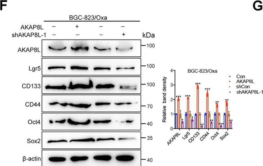 AKAP8L controls the chemoresistance in vivo.A 1 × 106 AKAP8L-overexpressing or AKAP8L-knockdown BGC-823/Oxa were implanted in nude mice (tumor development following treatment with Oxa once a week), tumors were dissected and representative images of the tumors are shown. B, C Tumor growth curves for orthotopic models. D Representative images of immunofluorescence staining of AKAP8L, Ki-67 and quantification analysis of AKAP8L, Ki-67 positive cells in xenograft tumors. Scale bar indicates 50 μm. E, F qPCR and Western blot analysis of the expression of AKAP8L, Lgr5, CD133, CD44, Oct4, and Sox2 in xenograft tumors. G Representative immunohistochemical staining of AKAP8L and CD133 in the indicated tumor tissues. Scale bar indicates 20 μm. H Immunofluorescence staining of TUNEL was performed to evaluate the apoptotic cells. Scale bar indicates 50 μm. I Western blot analysis of cleaved-caspase 3 and cleaved-PAPR. The values indicate the mean +/- SD of three independent experiments. *P < 0.05, **P < 0.01, ***P < 0.001. Image collected and cropped by CiteAb from the following open publication (//pubmed.ncbi.nlm.nih.gov/36522343), licensed under a CC-BY license. Not internally tested by Novus Biologicals.