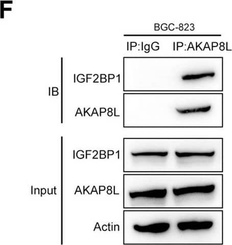 AKAP8L stabilizes of SCD1 mRNA via IGF2BP1-dependent manner.A m6A RIP and qPCR were used to determine the percentage of SCD1 mRNA with m6A modification in Mettl3 overexpressing cells. Affinity mass spectrometry (B–D) and Co-IP assay (E, F) were performed to detect the interaction of proteins with AKAP8L. G AKAP8L overexpressing cells were transiently transfected IGF2BP1 siRNA. The mRNA level of SCD1 was measured by qPCR. H RIP were used to determine the percentage of SCD1 mRNA with IGF2BP1 in BGC-823/Oxa cells. I BGC-823/Oxa cells were transiently transfected with control or siIGF2BP1 for 48 h and then treated with ActD for 0, 2, 4, 6, 8 h. The SCD1 mRNA level was determined using qPCR. The GAPDH mRNA level was used as a negative control. The values represent the mean +/- SD of three independent experiments (*P < 0.05, **P < 0.01, ***P < 0.001, independent Student’s t-test). Image collected and cropped by CiteAb from the following open publication (//pubmed.ncbi.nlm.nih.gov/36522343), licensed under a CC-BY license. Not internally tested by Novus Biologicals.