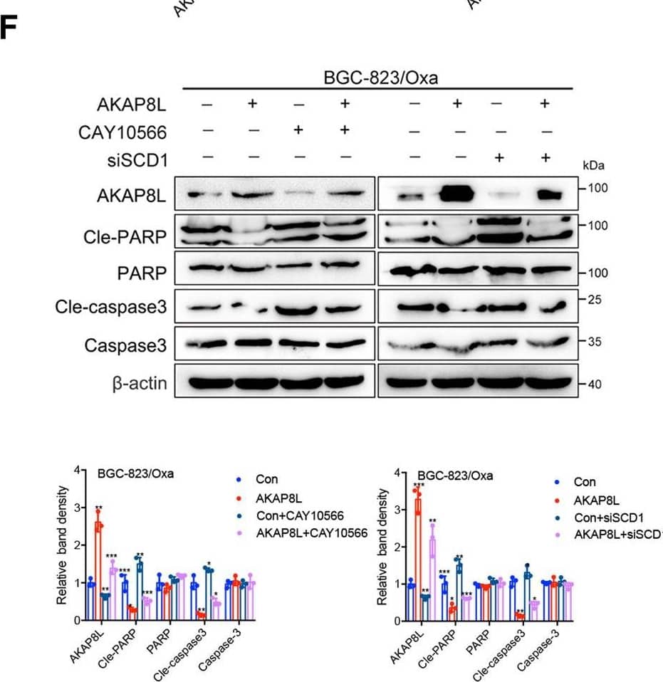 SCD1 mediates the effects of AKAP8L on GC cell stemness and chemoresistance.SCD1 siRNA was transiently transfected to AKAP8L overexpressing cells. SCD1 inhibitor (CAY10566) was added into AKAP8L overexpressing cells. A Representative images of spheroids in the SCD1 inhibitor, AKAP8L, AKAP8L/SCD1 inhibitor and the control groups. B, C qPCR and Western blot assays showed the stemness-related gene expression induced by AKAP8L/CAY10566 or AKAP8L/si-SCD1. D Cell viability was measured by MTT in four groups after the treatments of Oxa. E Representative images of flow cytometry showed the percentage of apoptotic cells in four groups after the treatments of Oxa. F Western blot analysis of cleaved-caspase 3 and cleaved-PAPR induced by AKAP8L/CAY10566 or AKAP8L/si-SCD1. Scale bar indicates 50 μm. The values indicate the mean +/- SD of three independent experiments. *P < 0.05, **P < 0.01, ***P < 0.001. Image collected and cropped by CiteAb from the following open publication (//pubmed.ncbi.nlm.nih.gov/36522343), licensed under a CC-BY license. Not internally tested by Novus Biologicals.