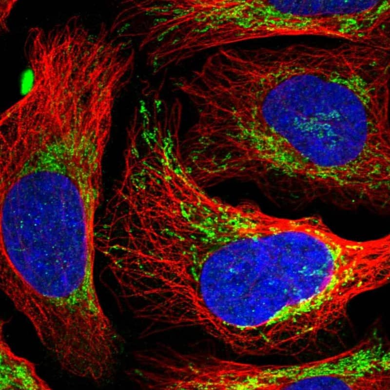 Immunocytochemistry/ Immunofluorescence EVC2 Antibody - BSA Free