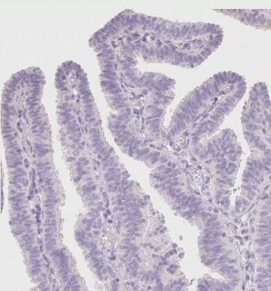 Staining of human fallopian tube shows no positivity in glandular cells as expected.