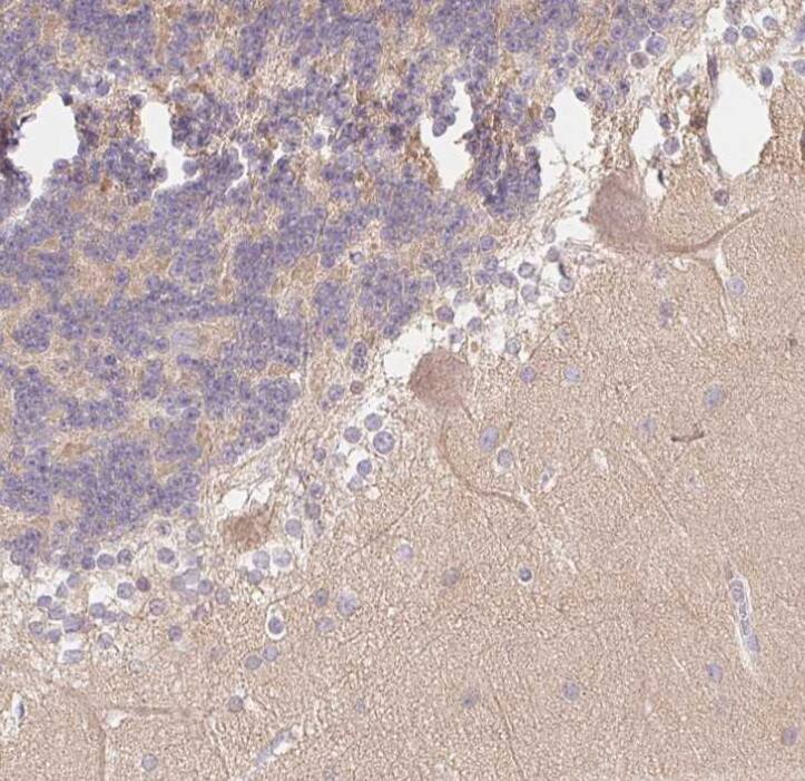 Staining of human cerebellum shows weak cytoplasmic positivity in Purkinje cells.