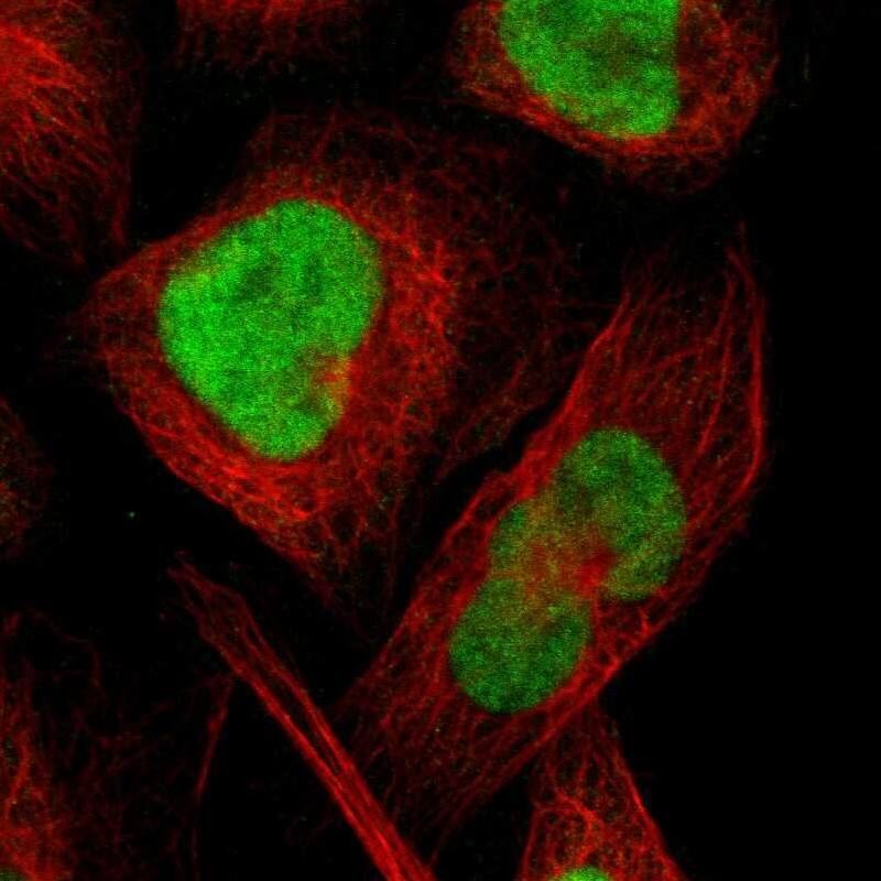 Immunocytochemistry/ Immunofluorescence CXorf67 Antibody - BSA Free