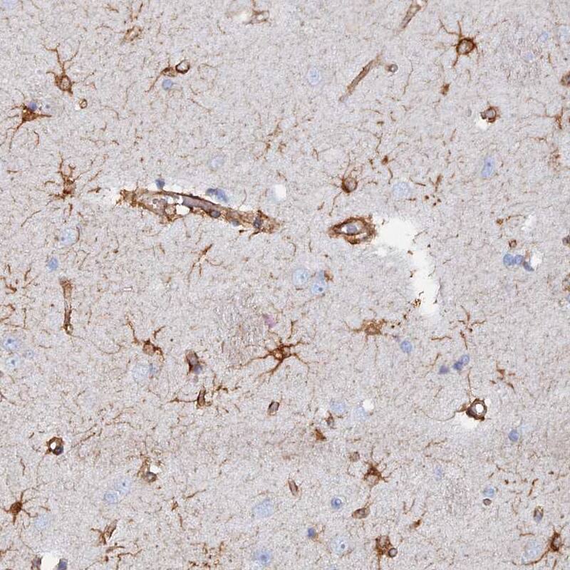 Staining of human caudate shows strong cytoplasmic positivity in astrocytes.