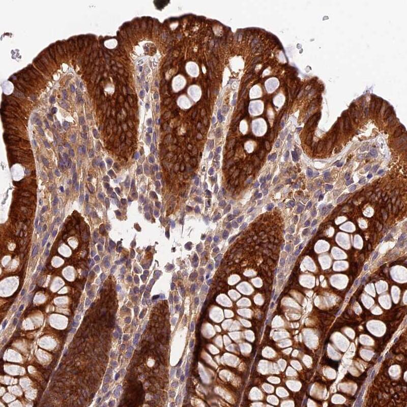 Immunohistochemistry-Paraffin Carboxylesterase 3/CES3/Esterase 31 Antibody - BSA Free