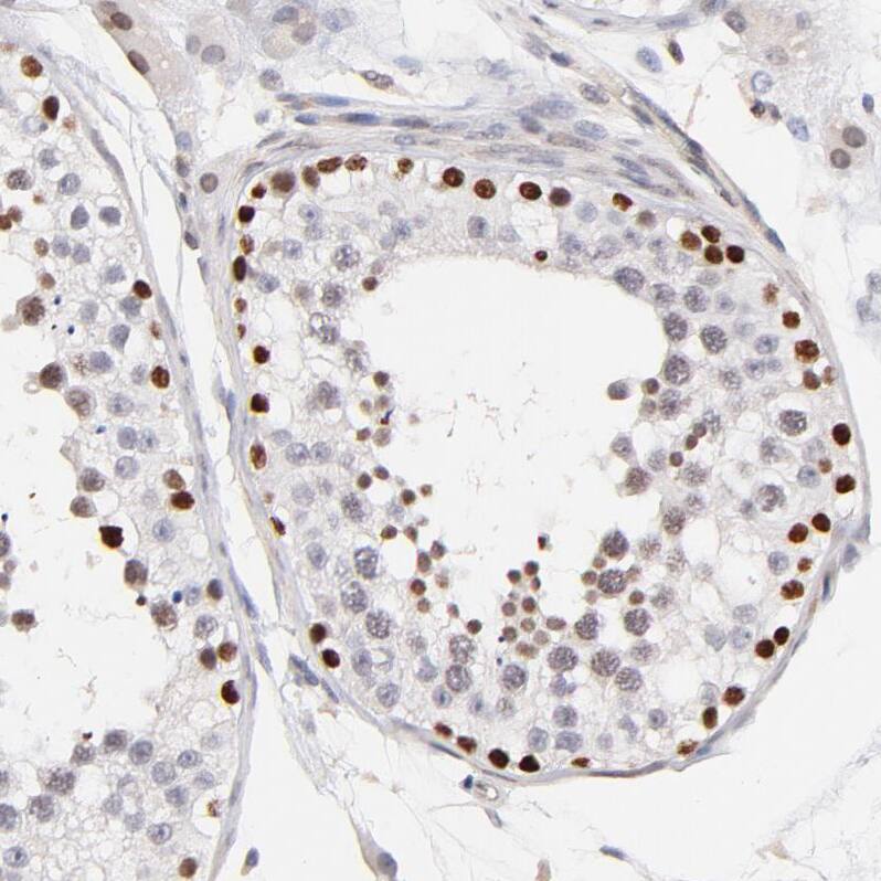 Staining of human testis shows strong nuclear positivity in cells in seminiferous ducts.