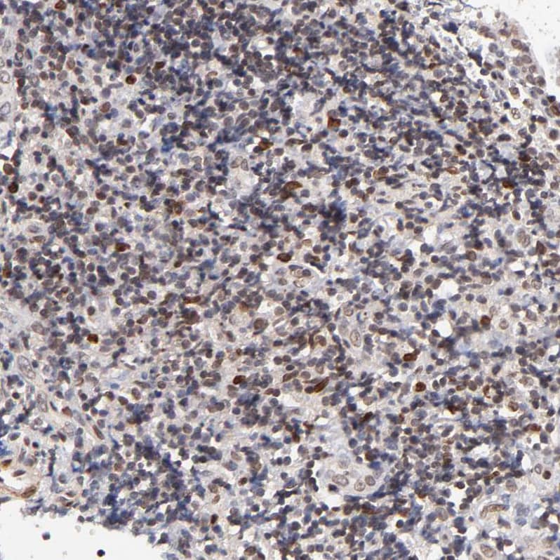Staining of human tonsil shows moderate nuclear positivity in non-germinal center cells.