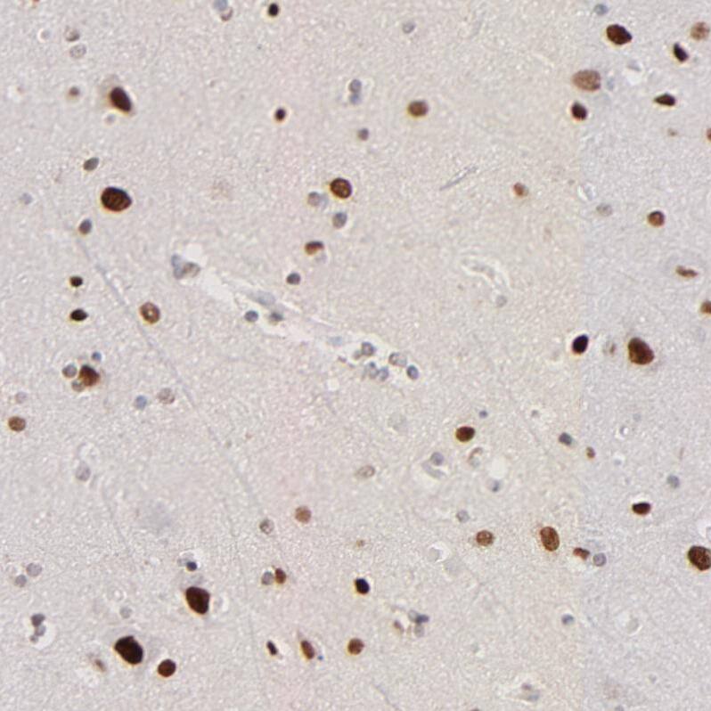 Staining of human cerebral cortex shows strong nuclear positivity in neurons.