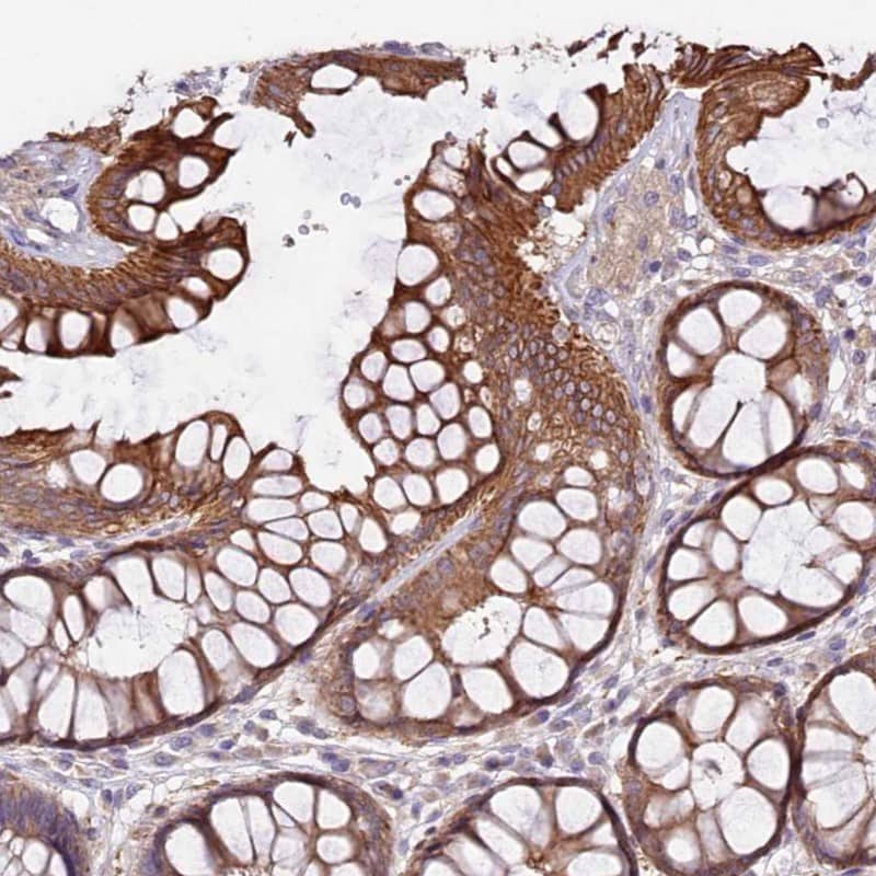 Staining of human rectum shows strong cytoplasmic and membranous positivity in glandular cells.