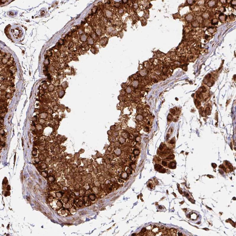 Immunohistochemistry-Paraffin TRAP1 Antibody - BSA Free