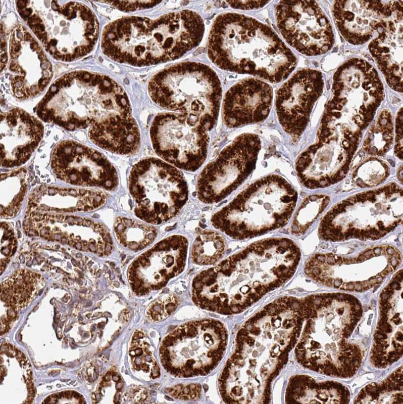 Immunohistochemistry-Paraffin TRAP1 Antibody - BSA Free