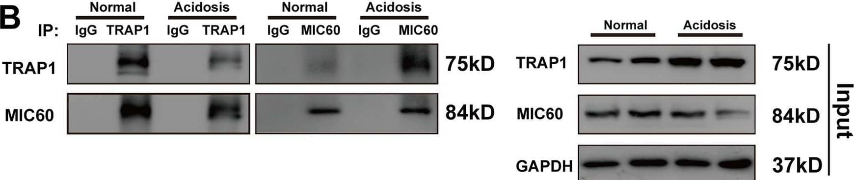 TRAP1 interacted with MIC60 and decreased MIC60 ubiquitination to increase MIC60 protein levels in rats’ heart tissue in extracellular acidosis.A Detection of the colocalization of MIC60 (green) and TRAP1 (red) using confocal microscopy in rat’s heart tissue. B Immunoblotting analysis of TRAP1 and MIC60 expression in a co-IP assay performed in protein lysate of rat’s heart tissue with anti-TRAP1 or anti-MIC60 Magnetic beads, respectively. C–D Western blot was used to determine the transfection efficiency of TRAP1 (C) and MIC60 (D) in rats’ heart tissue. E Western blotting was used to detect MIC60 protein levels regulated by TRAP1. F Western blot was used to detect MIC60 protein ubiquitination. Data were the means +/- SD from three independent experiments. Group comparisons were performed by one-way analysis of variance followed by Tukey’s post hoc test. &P < 0.05 vs. Normal group. #P < 0.05 vs. ov-Con group. ##P < 0.01 vs. ov-Con group. *P < 0.05 vs. sh-Con group. **P < 0.01 vs. sh-Con group. Image collected and cropped by CiteAb from the following open publication (//pubmed.ncbi.nlm.nih.gov/34907169), licensed under a CC-BY license. Not internally tested by Novus Biologicals.
