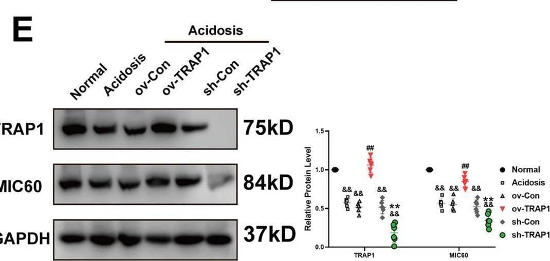 TRAP1 interacted with MIC60 and decreased MIC60 ubiquitination to increase MIC60 protein levels in rats’ heart tissue in extracellular acidosis.A Detection of the colocalization of MIC60 (green) and TRAP1 (red) using confocal microscopy in rat’s heart tissue. B Immunoblotting analysis of TRAP1 and MIC60 expression in a co-IP assay performed in protein lysate of rat’s heart tissue with anti-TRAP1 or anti-MIC60 Magnetic beads, respectively. C–D Western blot was used to determine the transfection efficiency of TRAP1 (C) and MIC60 (D) in rats’ heart tissue. E Western blotting was used to detect MIC60 protein levels regulated by TRAP1. F Western blot was used to detect MIC60 protein ubiquitination. Data were the means +/- SD from three independent experiments. Group comparisons were performed by one-way analysis of variance followed by Tukey’s post hoc test. &P < 0.05 vs. Normal group. #P < 0.05 vs. ov-Con group. ##P < 0.01 vs. ov-Con group. *P < 0.05 vs. sh-Con group. **P < 0.01 vs. sh-Con group. Image collected and cropped by CiteAb from the following open publication (//pubmed.ncbi.nlm.nih.gov/34907169), licensed under a CC-BY license. Not internally tested by Novus Biologicals.
