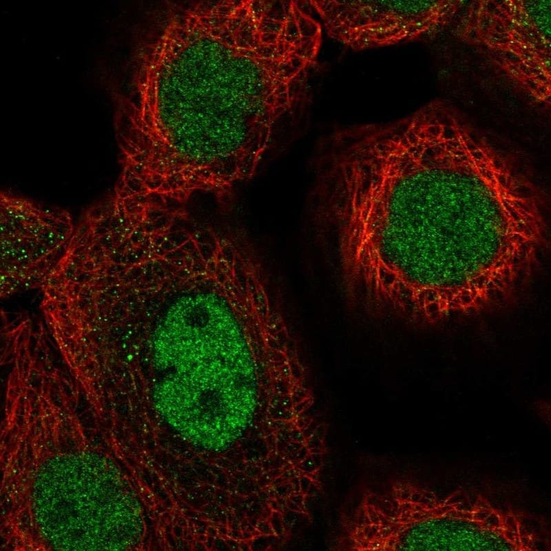 Immunocytochemistry/ Immunofluorescence TAF148 Antibody - BSA Free